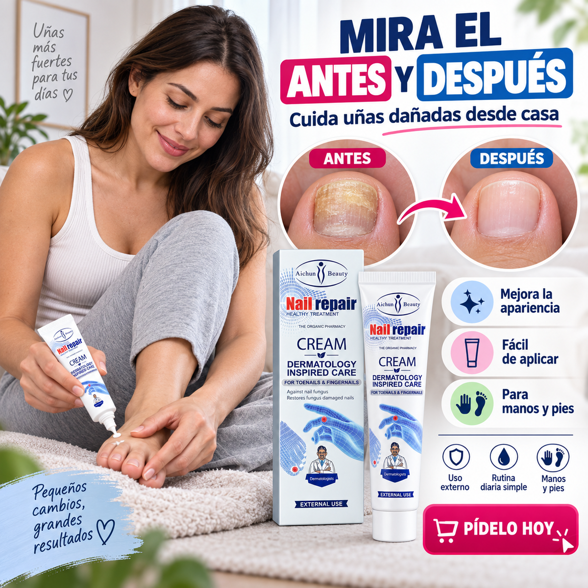 Crema para hongos de Uñas de Pies y Manos