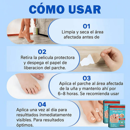 Elimina la infección de tus uñas por el hongo, irregularidades, coloración amarillenta y fractura    (32 Parches)