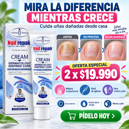 Crema para hongos de Uñas de Pies y Manos