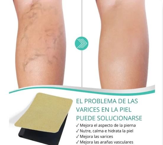Parches Anti-Varices