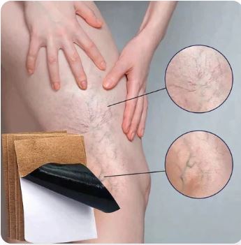 Parches Anti-Varices