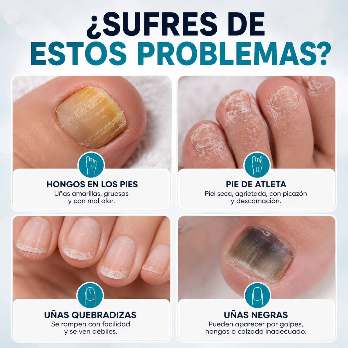 Crema para hongos de Uñas de Pies y Manos