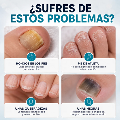 Crema para hongos de Uñas de Pies y Manos