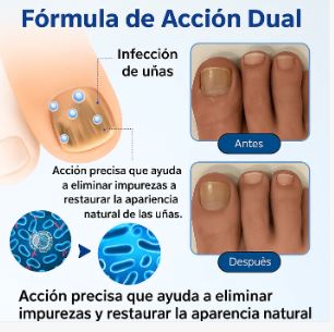 Elimina la infección de tus uñas por el hongo, irregularidades, coloración amarillenta y fractura    (32 Parches)